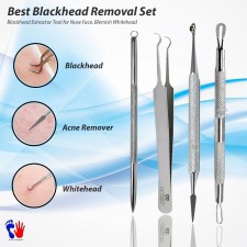 BLACKHEAD REMOVER TOOL KIT SPOT ACNE PIMPLE COMEDONE TWEEZERS EXTRACTOR TOOLS